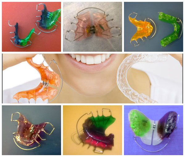 κινητοι μασελακια