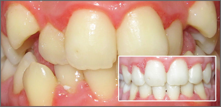 ορτηοδοντικες ανωμαλιες