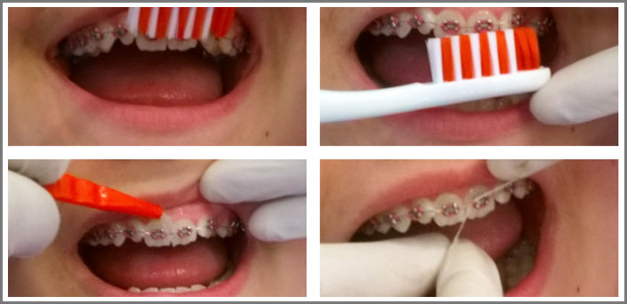 ορθοδοντικες συμβουλες