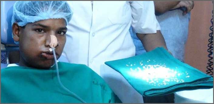 το παιδι με 232 δοντια