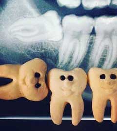 εξατικη δοντιων πειραια