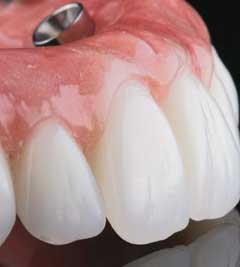 τεχνητες οδοντοστοιχιες