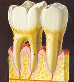 περιοδοντολογια κεντρο πειραια