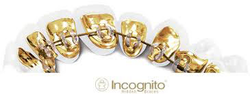 incognito σιδερακια