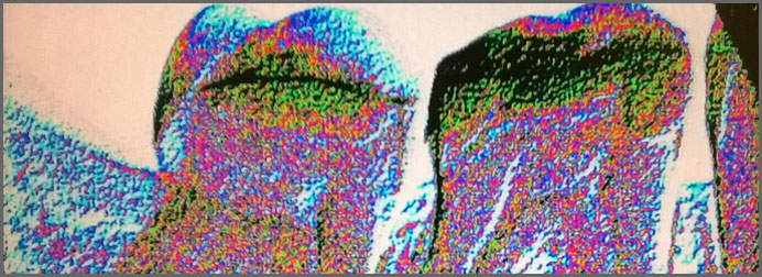 ψηφιακή ακτινογραφία δοντιου