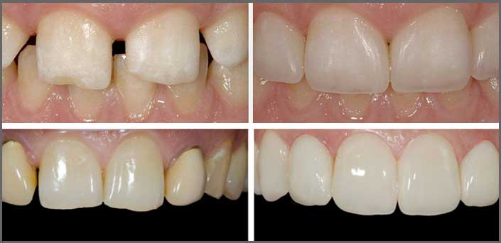 αμεσα οψεις