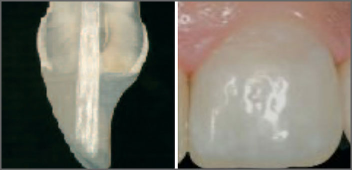 ανασύσταση με άξονα κεντρο