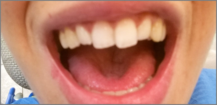 ασκησεις για βργμου