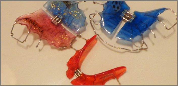 διαφορες ειδων κινητων μηχανισμων