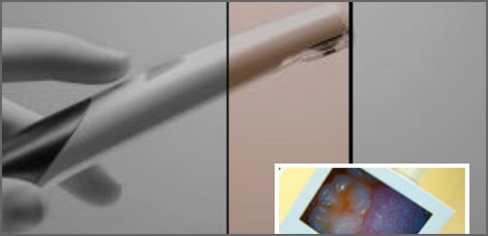 ενδοστοματικη καμερα