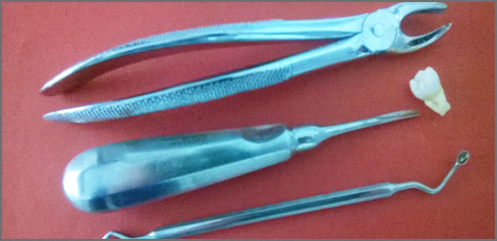 ΕΞΑΚΤΙΚΗ δοντιου πειραια