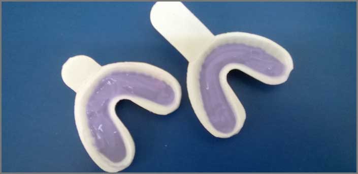 φθοριωση για παιδικα δοντια