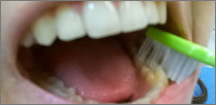 αντιμετώπιση κακοσμίας