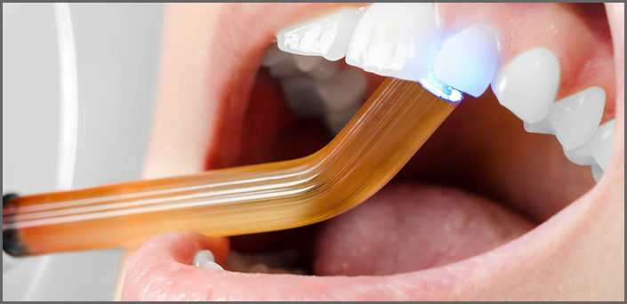 λευκά σφραγίσματα