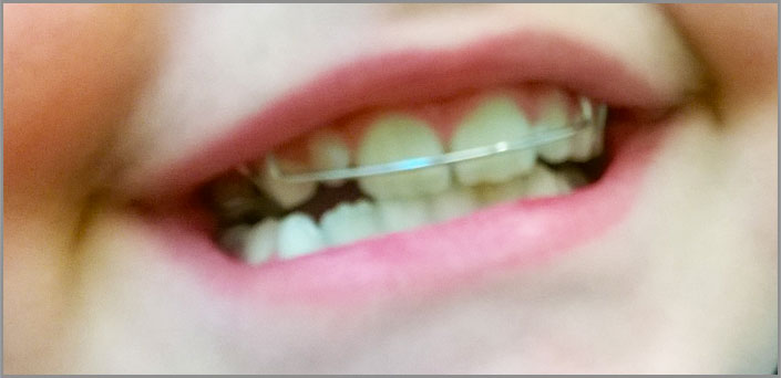 ΠΑΙΔΟΔΟΝΤΙΑ παιδοδοντιατροσ κεντρο πειραια