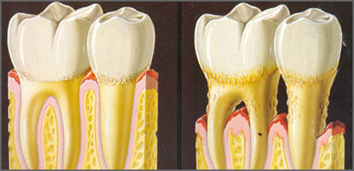 ΠΕΡΙΟΔΟΝΤΟΛΟΓΙΑ πειραια οδοντιατρος