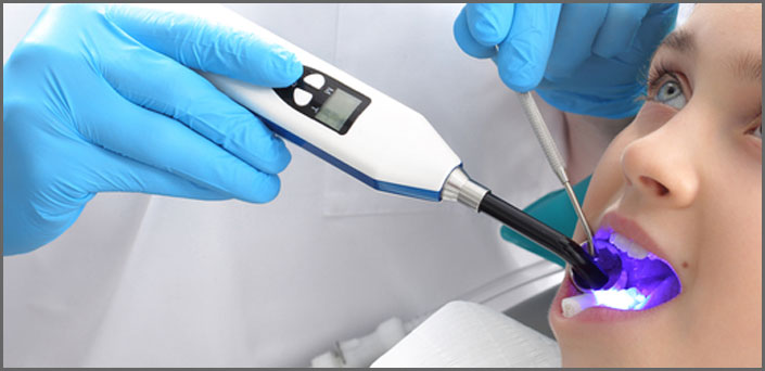 sealant για παιδικα δοντια