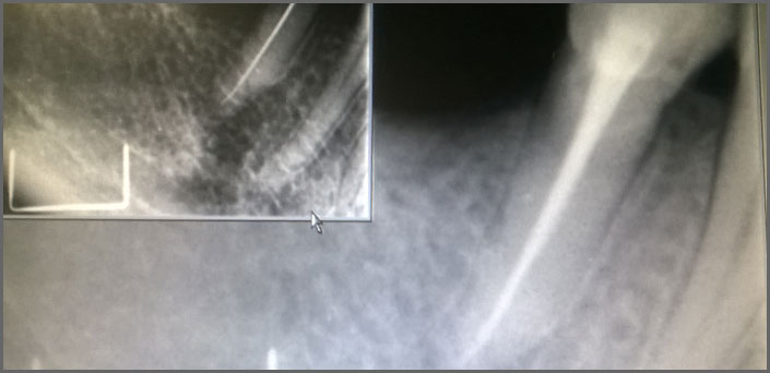ΔΙΑΓΝΩΣΤΙΚΟΣ στοματολογικος  ΕΛΕΓΧΟΣ