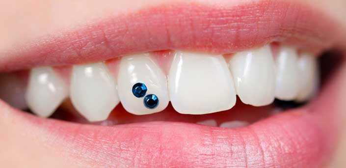 Οδοντική Strass δοντιου